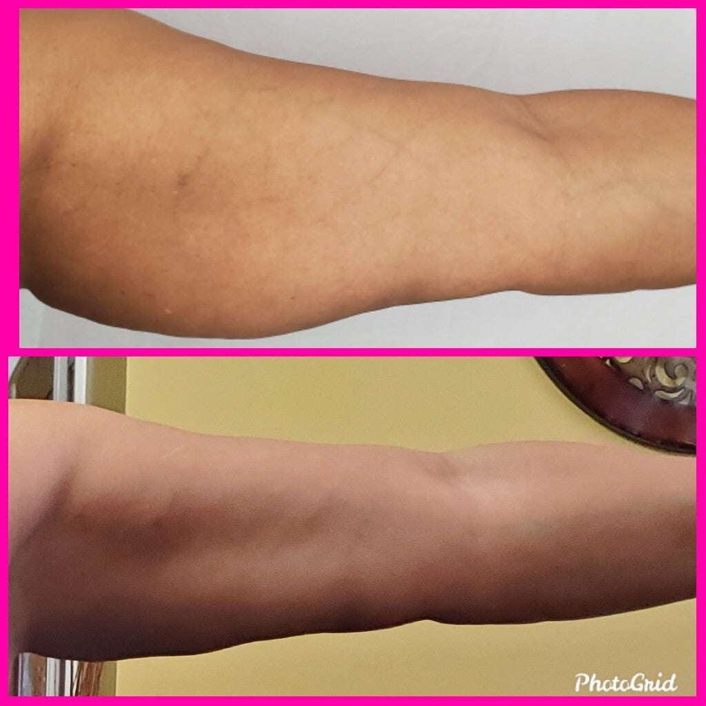Lymphatic Massage Oil Lymphatic Drainage/Post Surgery Recovery- 2 Oz.